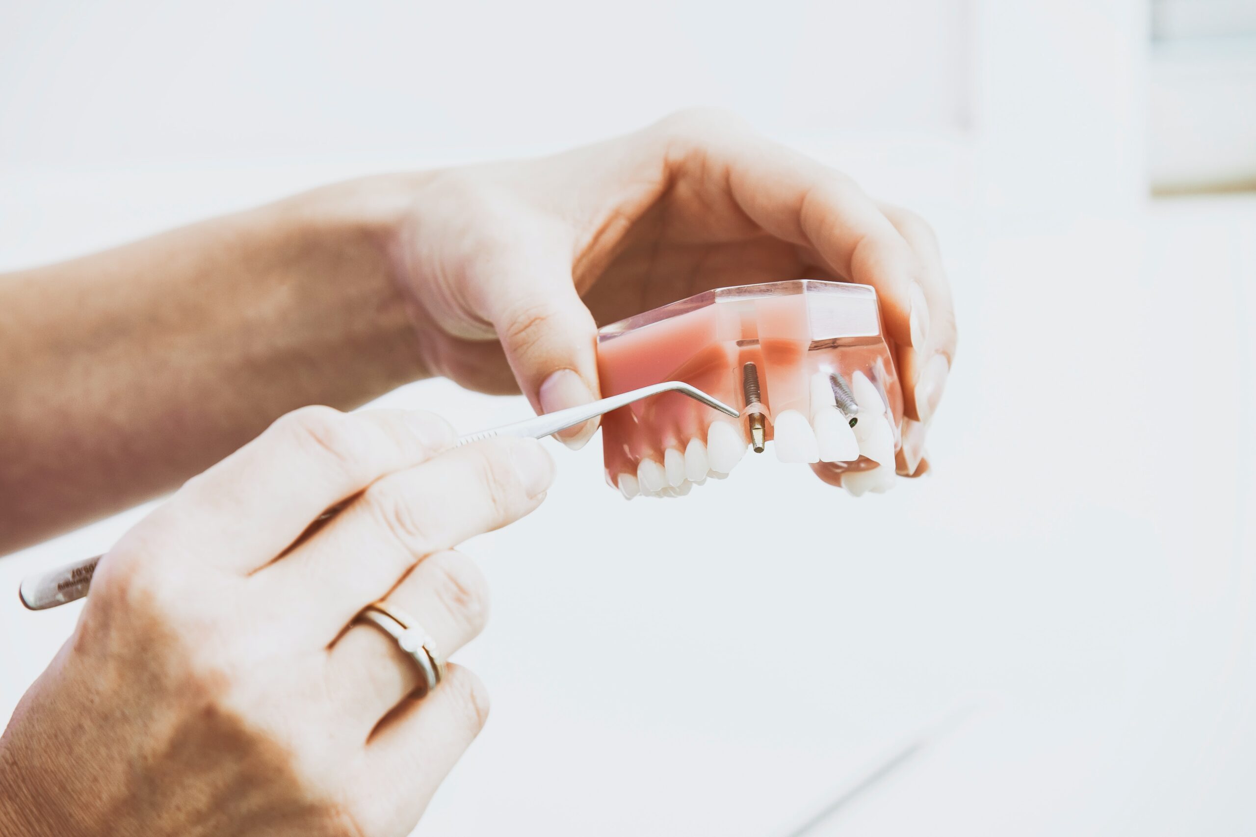 Common Dental Injuries