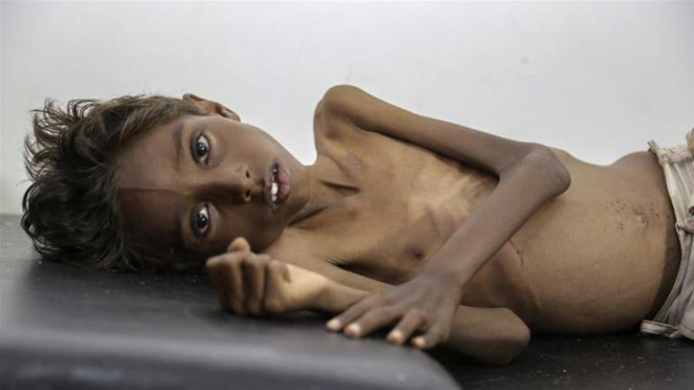 Yemen: The Forgotten Conflict