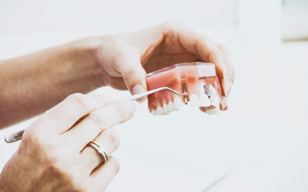 Common Dental Injuries
