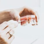 Common Dental Injuries